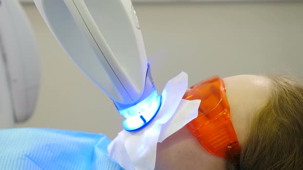 Professional Teeth Whitening or Bleaching Procedure in Modern Dental Clinic alt