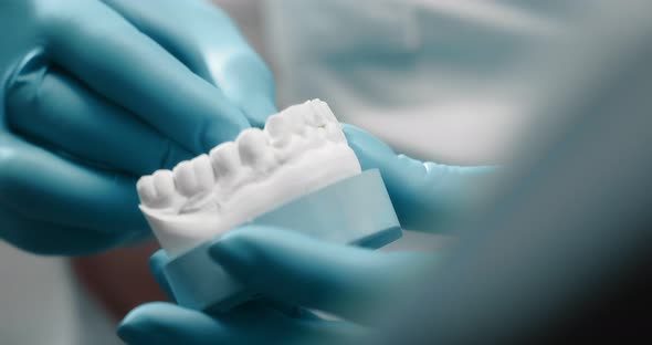Hands of Dentist Place Dental Implant in Plaster Model of Teeth alt