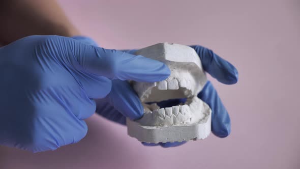 3d Model Dental Plaster Cast Hands Orthodontist alt