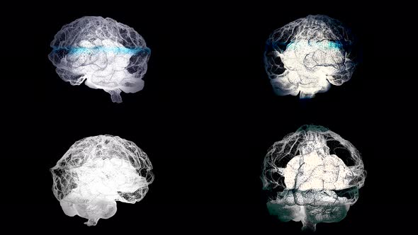 Human brain, right and left hemispheres during medical procedure alt