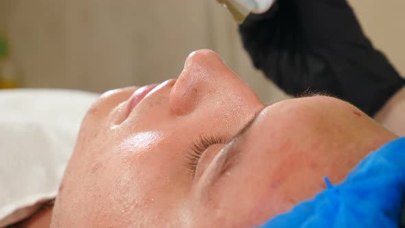 Ultrasonic Skin Cleaning Procedure on Male Face alt