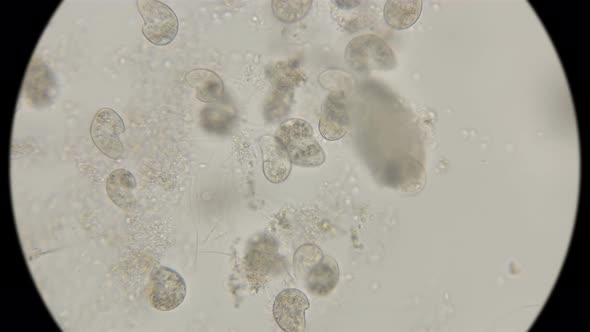 Ciliates Colpoda Class Colpodea  alt