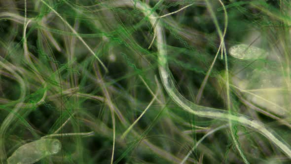 Algae Under the Microscope, the Movement of a Large Number of Algae in Accelerated Shooting alt