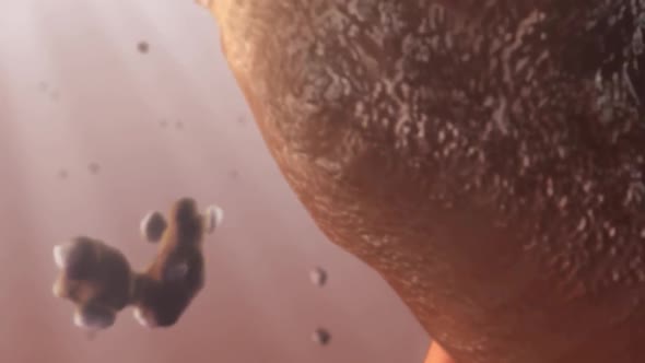 journey of kidney stone in human body alt