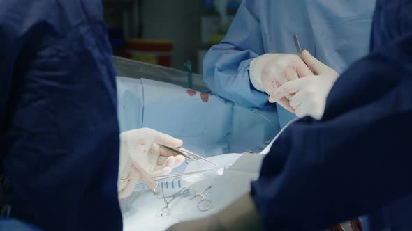 Surgeons working during open heart surgery, close up on hands and instruments. alt