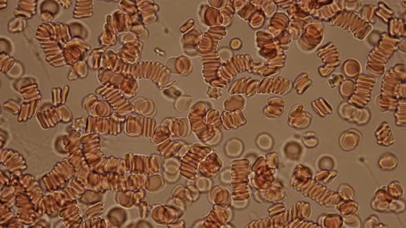 Blood Under a Microscope, Adhering Red Blood Cells in Clotted Blood, They Are Also Called the Effect alt