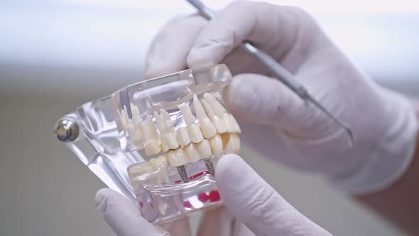 Doctor shows on a plastic jaw sample or model different methods of teeth treatment. alt