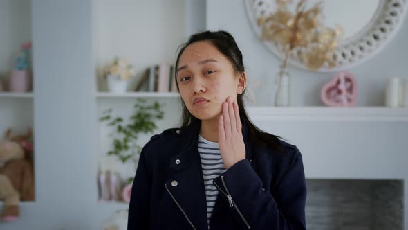 Young Asian Beautiful Girl Girl with Problem Skin