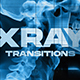 X-Ray Human Transitions - VideoHive Item for Sale