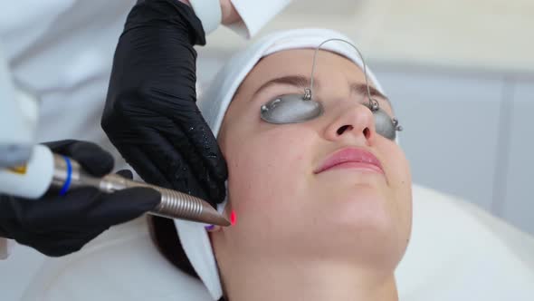 Aesthetician is Curing Rosacea and Coagulating Capillary By Laser Apparatus in Modern Beauty Clinic alt