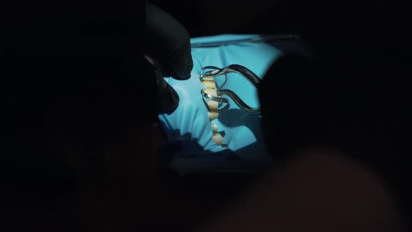 A Dentist Doing Surgery Close-up
