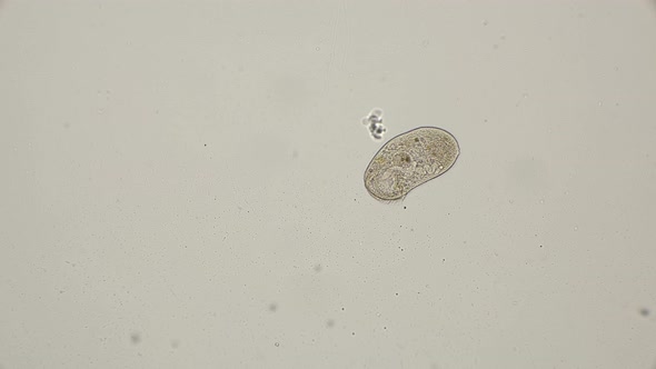 Ciliate Stentor in Free Swimming alt
