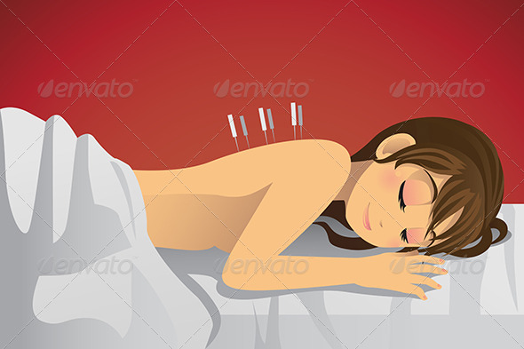 Acupuncture Treatment - Health/Medicine Conceptual