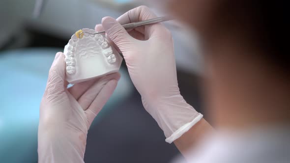 Crop dentist making cast of jaw alt