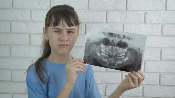 A child with an x-ray of his teeth.  alt