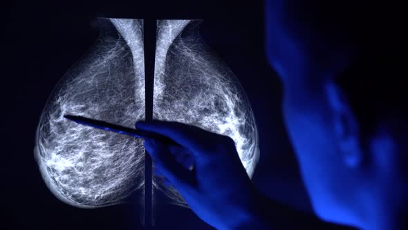 Doctor with a pan checking mammogram x-ray. Mammography diagnostic in 4k. Close-up