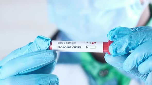 Hand in Blue Medical Gloves Holding Blood Test Tube alt