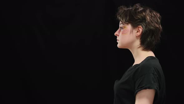 Young Abused Woman with Beaten Face in Bruises Standing on Black Background Turning to Camera and alt