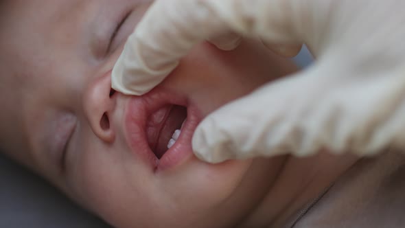 Doctors Hands Check Sleeping Baby Infant First Milk Teething in Gums Dentition alt