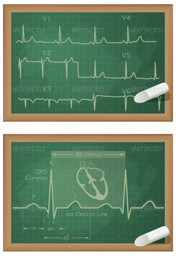 Understanding Heart ECG Board - Illustration by designpraxis | GraphicRiver