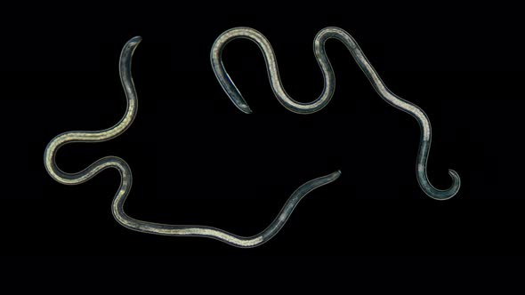 A Nematode Worm Under a Microscope, There Are Free-living, Commensals and Parasites alt