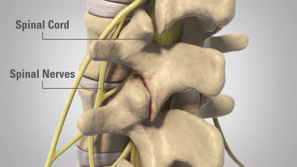 Backbone Laminectomy Degenerative Dics Disease alt
