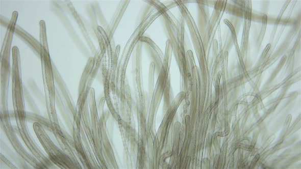 Worm Polychaeta of Family Terebellidae Under the Microscope Phylum Annelida alt