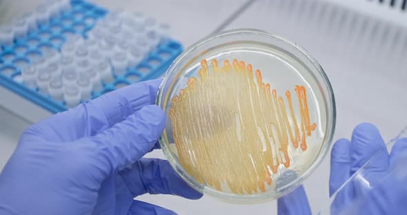 Scientist examines a petri dish with bacteria