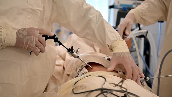Close View of Laparoscopic Appendectomy Operation at the Children's Regional Hospital