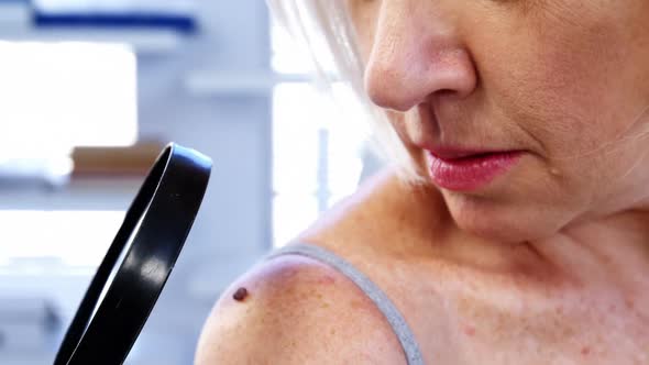 Dermatologist Examining Mole with Magnifying Glass alt