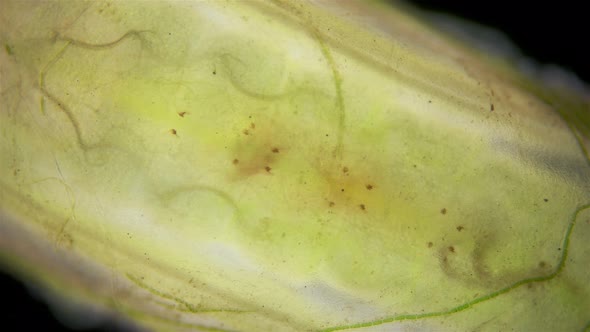 Trichoptera pupa under a microscope, family Hydroptilidae alt