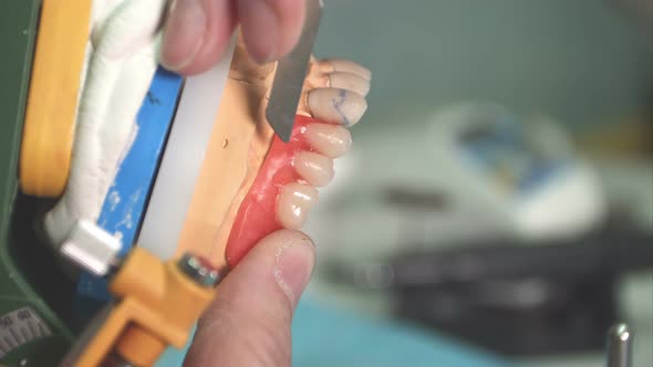 Lab Technician Removing Imperfections From Dental Implant alt