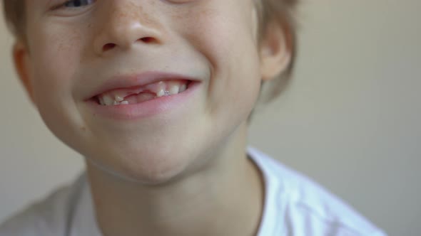 Little Boy Shows That Some of His Milk Teeth Had Fallen Out. Concept of Tooth Change in Children alt