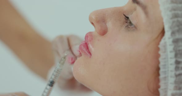 Close Up of Female Lips Having Hyaluronic Acid Lifting By Syringe