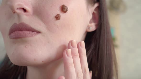 Close Up of Moles on the Face of a Young Woman, Stock Footage | VideoHive