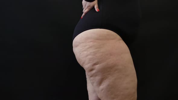 Fat Woman with Cellulite on Her Legs on a Black Background