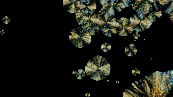 the Formation of Crystals Under a Microscope, a Solution of Metamizol Sodium or Analginum and alt