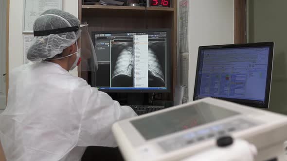 Doctor looks at X-ray of thorax on computer screen in office