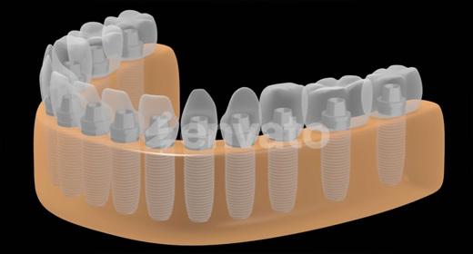 Teeth