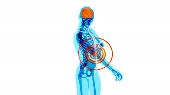 4K anatomy concept of an elbow pain alt