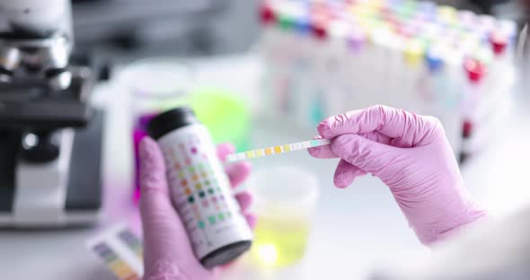Doctor Evaluating Urine Analysis Using Test Strips in Lab Closeup  Movie Slow Motion alt