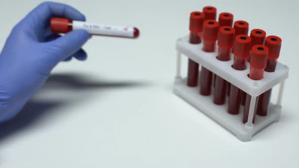 Positive Flu RSV Test, Doctor Showing Blood Sample, Lab Research, Health Checkup alt