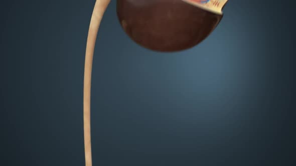 Kidney Stone Treatment. Lithotripsy. alt