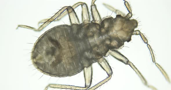 Bed Bug Nymph Cimex Lectularius Under a Microscope Order Hemiptera Family Cimicidae alt