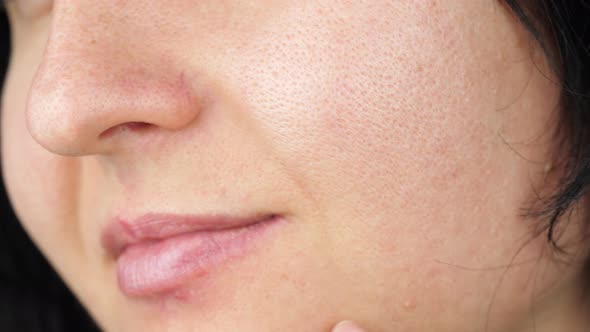 Skin Texture with Enlarged Pores. Part of a Woman's Face. The Concept of Health and Environmental alt