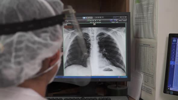 Doctor in coat and protective shield looks at X-ray of thorax on computer screen. Physician sits at