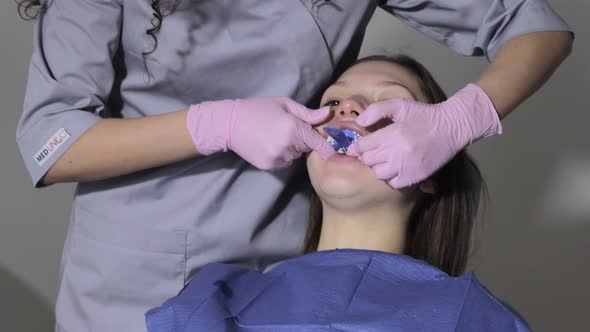 The orthodontist using dental impression tray on woman teeth.  alt