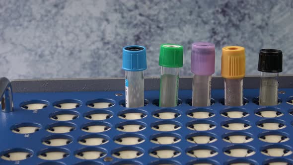 Plastic test tubes with caps for the collection of samples. Test tube rack. Medical modern medicine