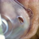 Senior Women Using Nebulizer Close Up - VideoHive Item for Sale