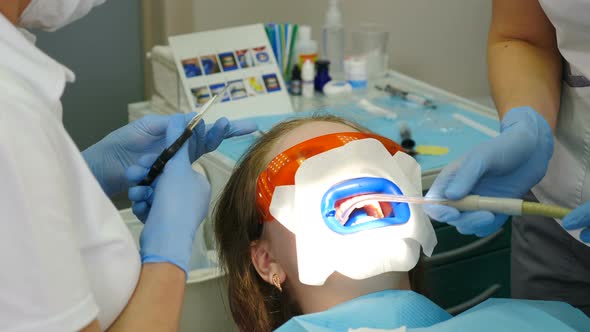 Dental Bleaching Procedure alt